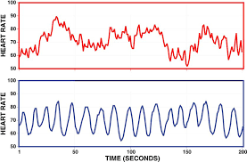 HRV Image
